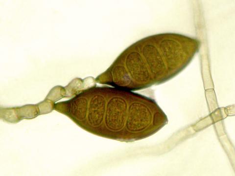 Exserohilum_pedicellatum_2