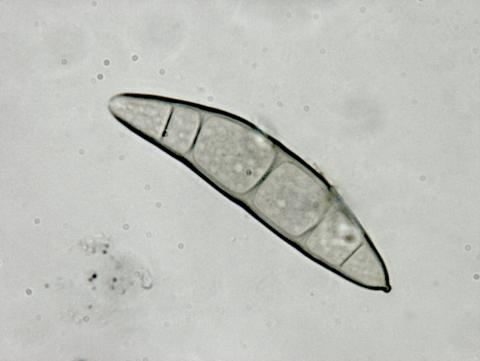 Exserohilum_turcicum_2