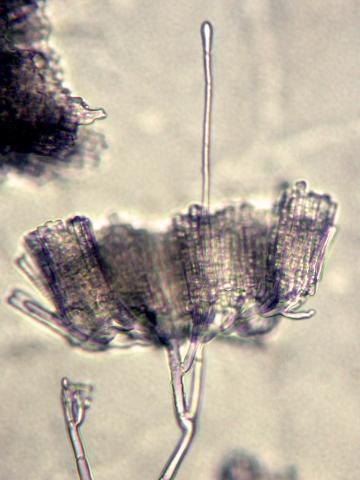Cylindrocladium_sp_2