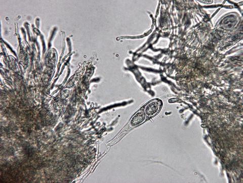 Didymascella_thujina_1