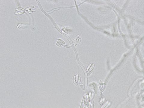 Fusarium_proliferatum_4