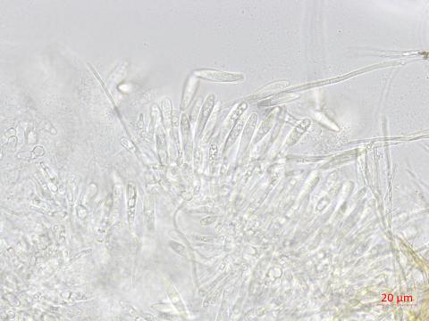 Fusicoccum_aesculi_1