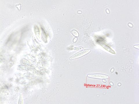 Fusicoccum_aesculi_2