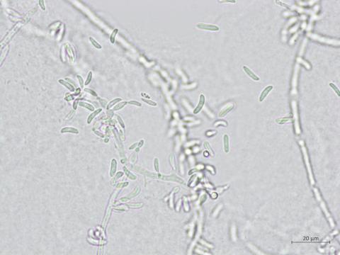 Microdochium_sp_4