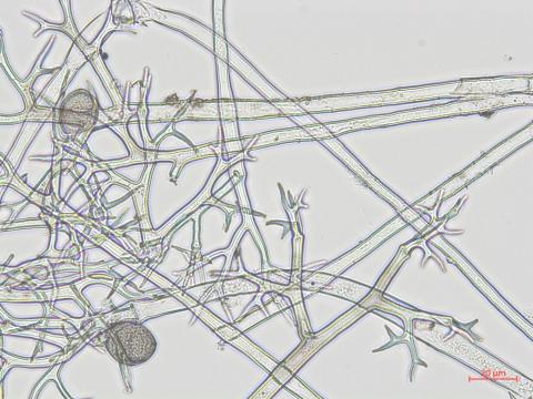 Pseudoperonospora_sp_1