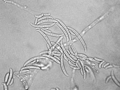 Fusarium_oxysporum_1
