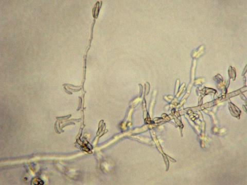Fusarium_oxysporum_2