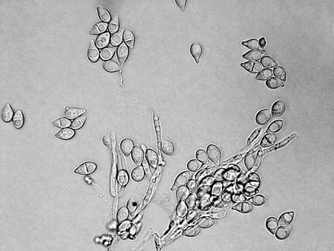Fusarium_tricinctum_1