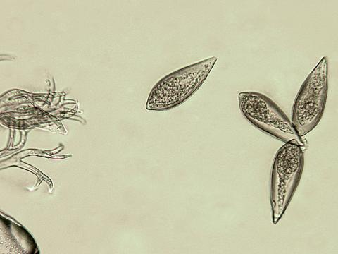 Peronospora_destructor_2