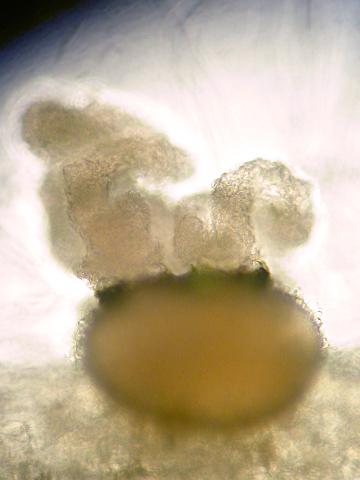 Phoma_sp_2