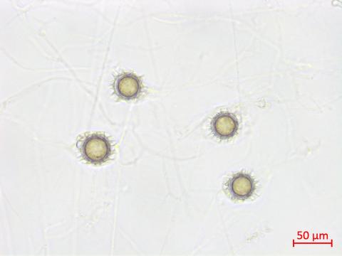 Pythium_uncinulatum_1