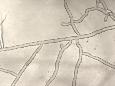 Rhizoctonia_sp_1