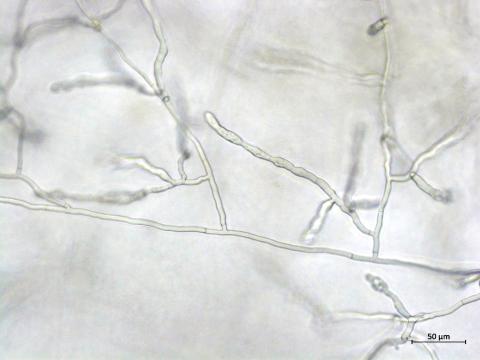 Rhizoctonia_sp_2