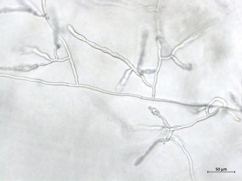 Rhizoctonia_sp_4