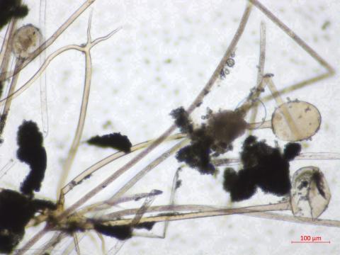 Rhizopus_sp_3