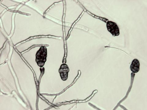 Stemphylium_sp_2