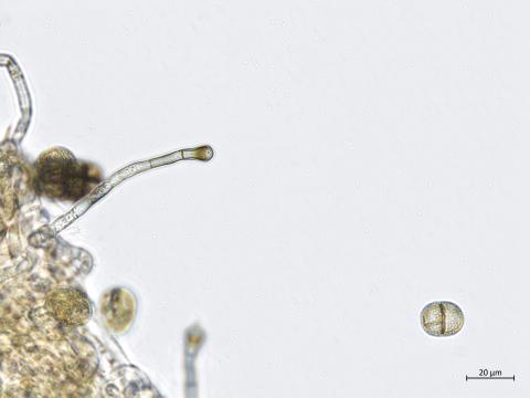 Stemphylium_sp_6