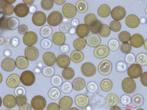 Tilletia_maclaganii_1