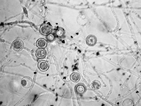 Pythium_dissotocum_1