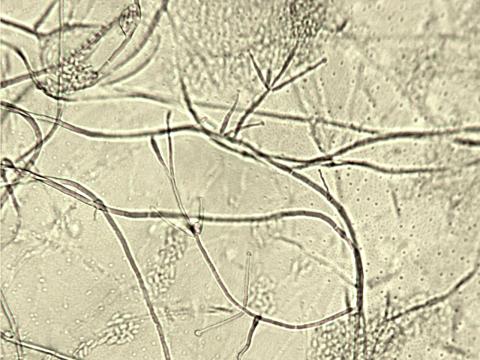 Verticillium_dahliae_1