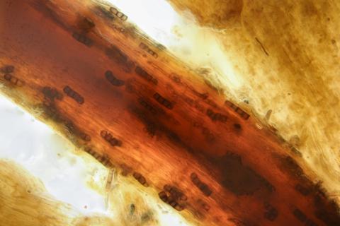 Berkeleyomyces_basicola_1