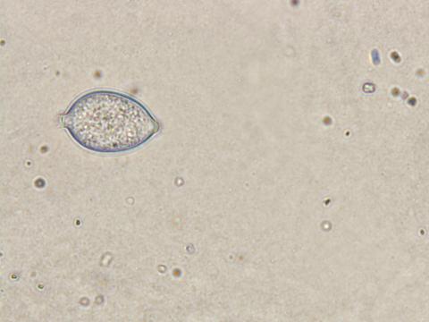 Phytophthora_infestans_2