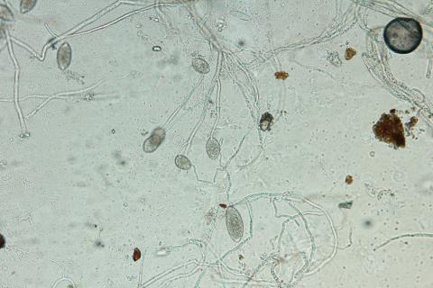 Phytophthora_infestans_6