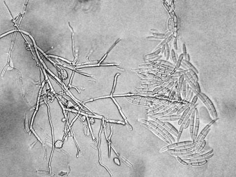 Fusarium_proliferatum_2