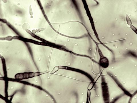 Alternaria_cichorii_4