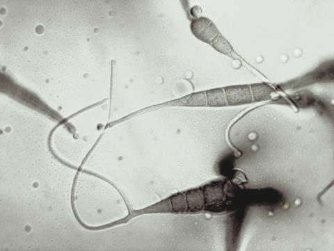 Alternaria_cichorii_6