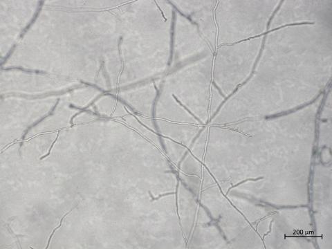 Aphanomyces_euteiches_1