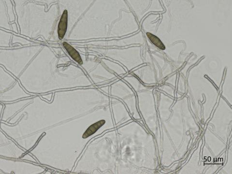 Bipolaris_sorokiniana_1