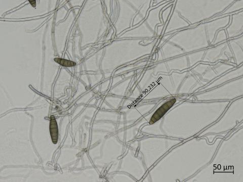 Bipolaris_sorokiniana_3