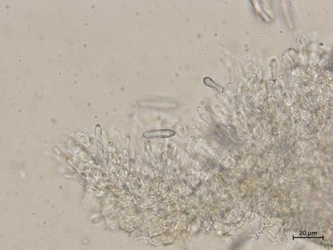 Botryosphaeria_dothidea_2