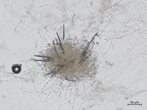 Colletotrichum_siamense_3