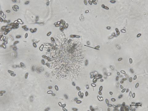 Coniella_diplodiella_4