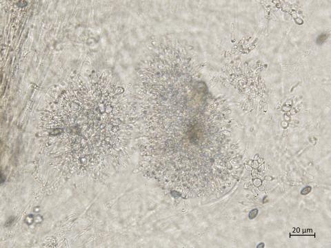 Coniella_diplodiella_5