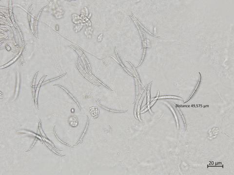 Fusarium_oxysporum_6