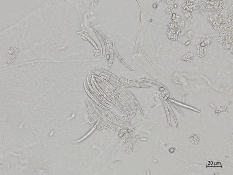 Fusarium_oxysporum_5