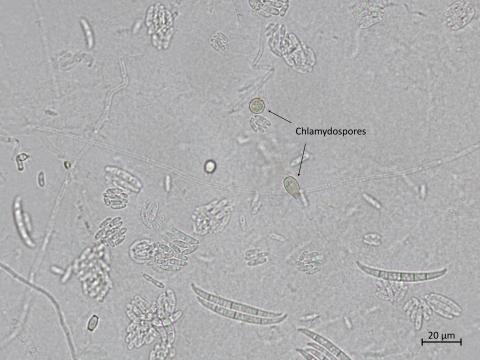 Fusarium_oxysporum_8