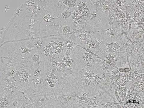 Fusarium_oxysporum_7