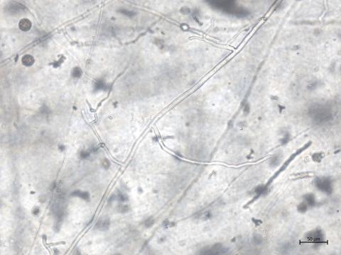 Globisporangium_irregulare_1