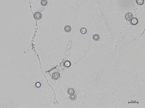 Globisporangium_irregulare_4