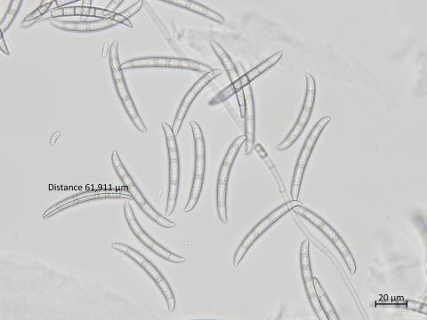 Neocosmospora_solani_1