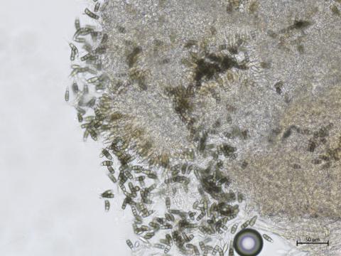 Neopestalotiopsis_sp_1