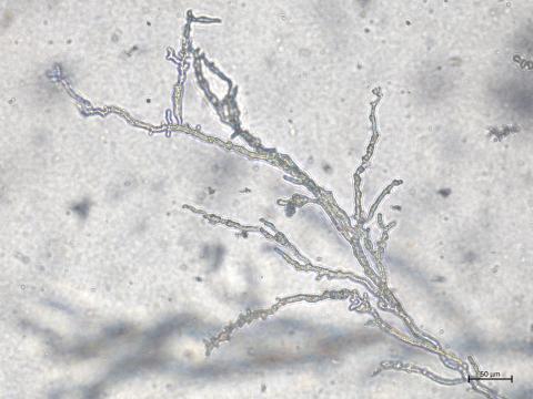 Phytophthora_cactorum_2