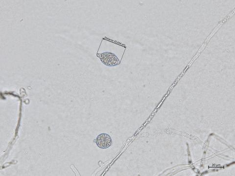 Phytophthora_cactorum_5