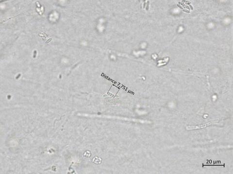 Plectosphaerella_cucumerina_3