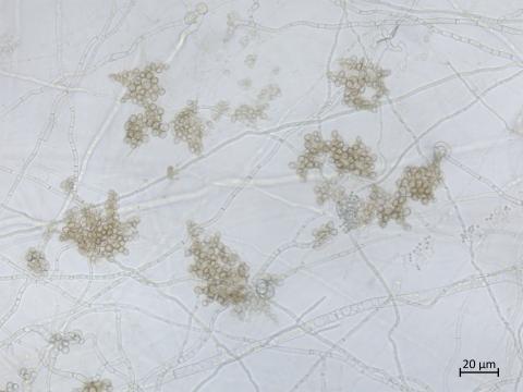 Sclerotinia_sclerotiorum_4