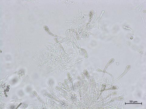 Chaetomium_sp_4